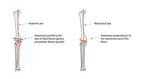 The Importance of Regular Alignment Checks